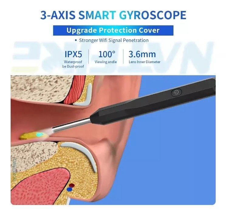 OTOSCOPIO Digital Inalámbrico Con App Multifuncional Visual - Imagen 8