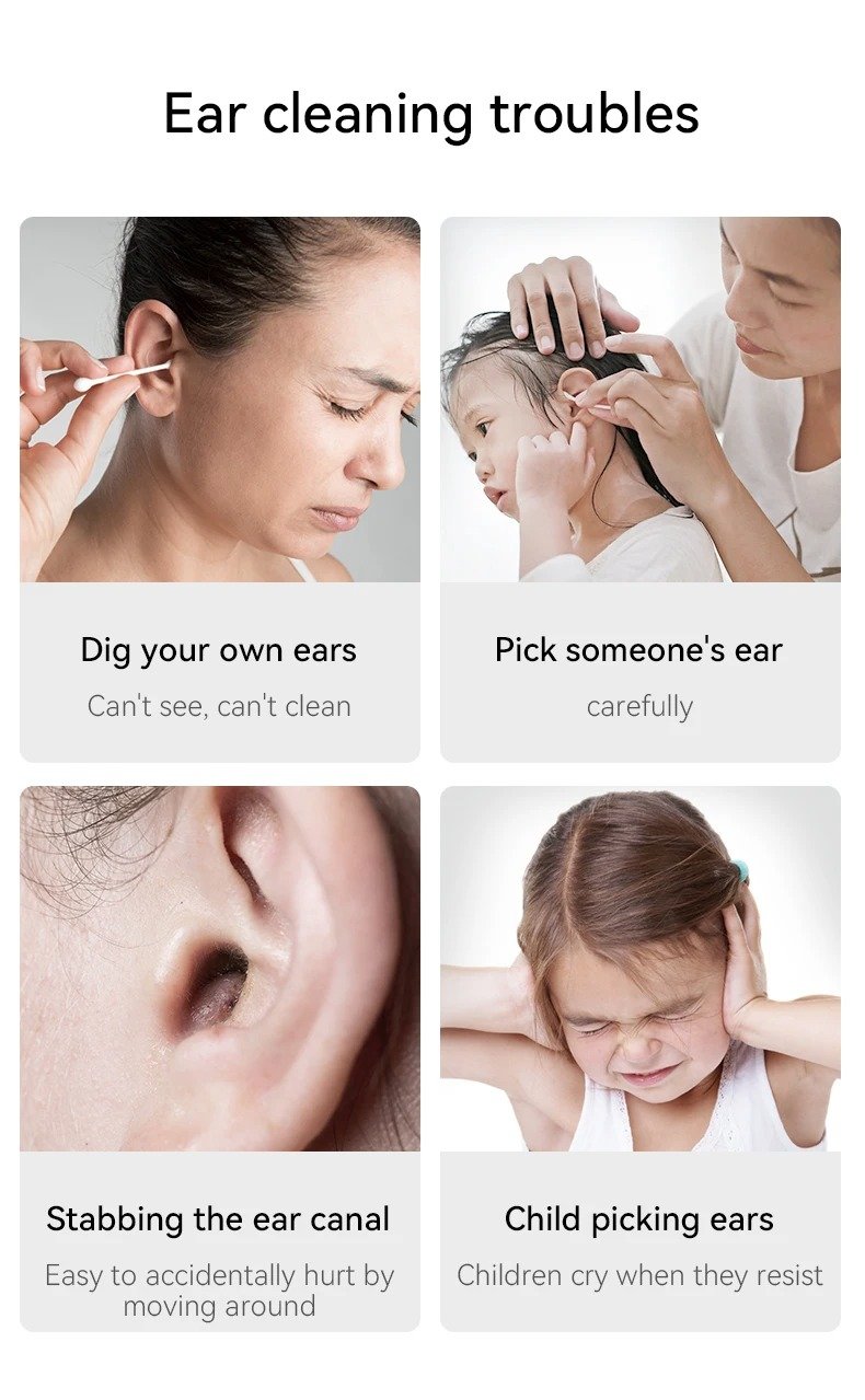 OTOSCOPIO Digital Inalámbrico Con App Multifuncional Visual - Imagen 5